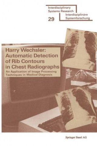 Buch Automatic Detection of Rib Contours in Chest Radiographs WECHSLER