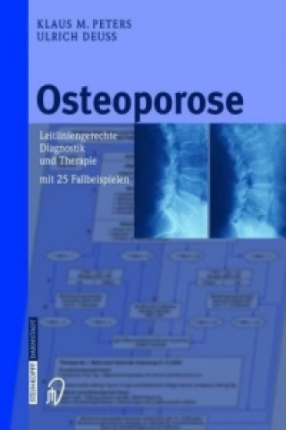 Könyv Osteoporose Klaus M. Peters