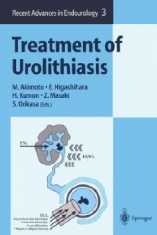 Kniha Treatment of Urolithiasis M. Akimoto