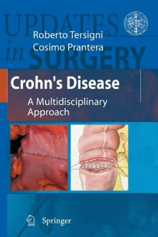 Kniha Crohn's Disease Roberto Tersigni