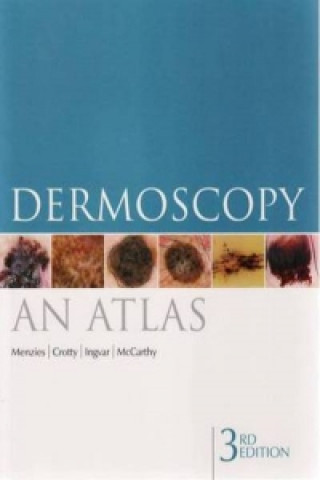 Książka Dermoscopy Scott Menzies