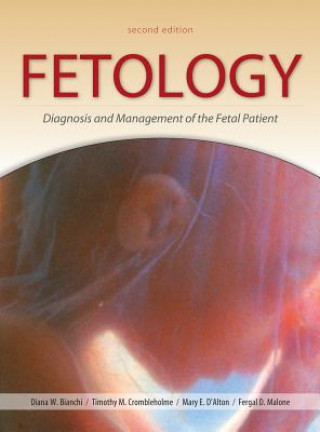 Carte Fetology: Diagnosis and Management of the Fetal Patient, Second Edition Diana Bianchi