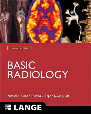 Knjiga Basic Radiology, Second Edition Michael Chen