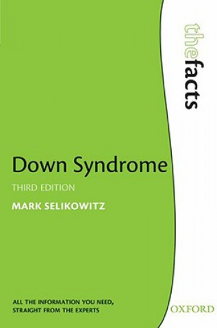 Kniha Down Syndrome Mark Selikowitz