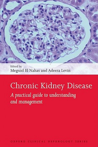 Książka Chronic Kidney Disease Adeera El Nahas
