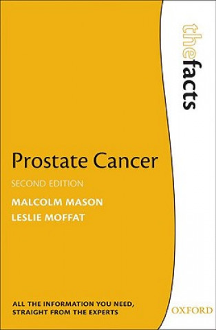 Βιβλίο Prostate Cancer Malcolm Mason