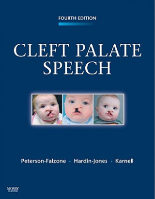 Könyv Cleft Palate Speech Sally Peterson-Falzone