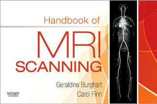 Livre Handbook of MRI Scanning Geraldine Burghart