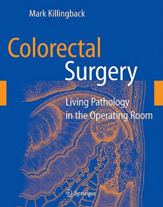 Könyv Colorectal Surgery Mark Killingback