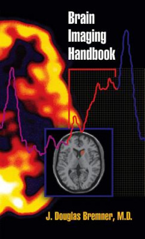 Könyv Brain Imaging Handbook J  Douglas Bremner