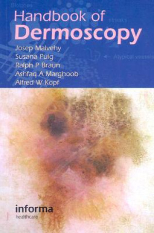 Carte Handbook of Dermoscopy Josef Malvehy