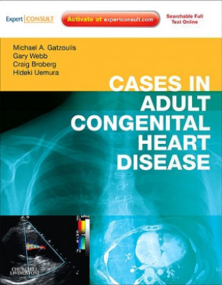 Könyv Cases in Adult Congenital Heart Disease - Expert Consult: Online and Print Michael Gatzoulis