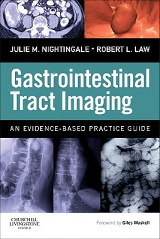 Книга Gastrointestinal Tract Imaging Julie Nightingale
