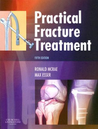 Книга Practical Fracture Treatment Ronald McRae