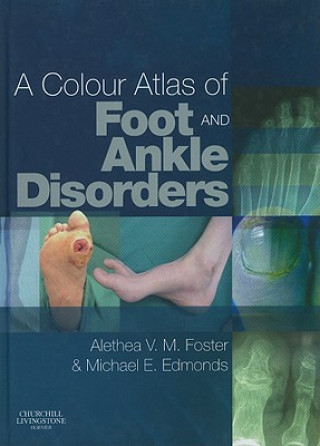 Carte Colour Atlas of Foot and Ankle Disorders Michael Edmonds