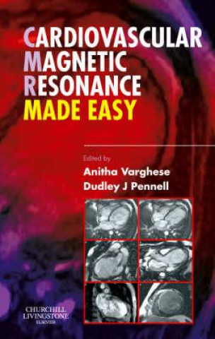 Kniha Cardiovascular Magnetic Resonance Made Easy Anitha Varghese