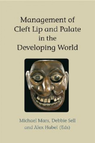 Livre Management of Cleft Lip and Palate in the Developing World Michael Mars