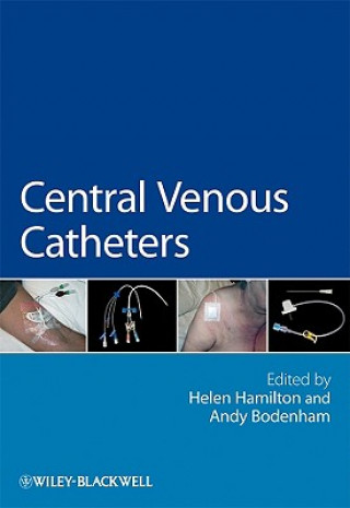 Kniha Central Venous Catheters Helen Hamilton