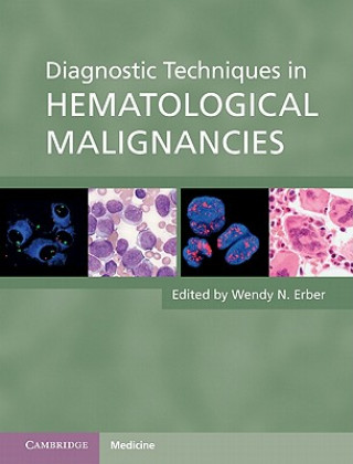 Livre Diagnostic Techniques in Hematological Malignancies Wendy N Erber