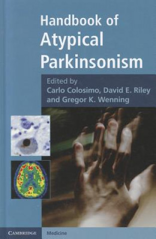 Kniha Handbook of Atypical Parkinsonism Carlo Colosimo