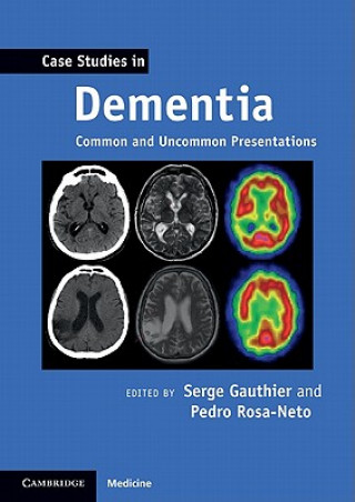 Carte Case Studies in Dementia: Volume 1 Serge Gauthier