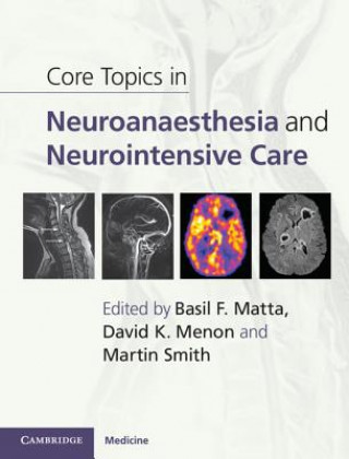 Książka Core Topics in Neuroanaesthesia and Neurointensive Care Basil Matta