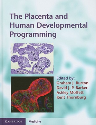 Carte Placenta and Human Developmental Programming Graham J Burton
