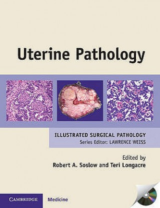 Kniha Uterine Pathology Robert Soslow
