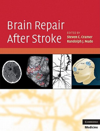 Книга Brain Repair After Stroke Steven C Cramer