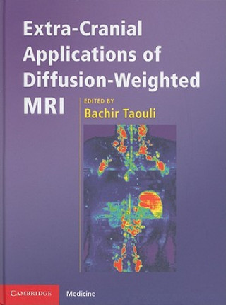 Kniha Extra-Cranial Applications of Diffusion-Weighted MRI Bachir Taouli