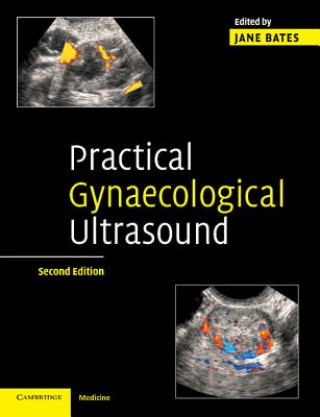 Kniha Practical Gynaecological Ultrasound Jane Bates