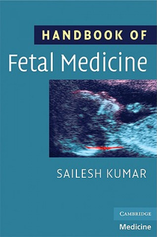 Carte Handbook of Fetal Medicine Sailesh Kumar