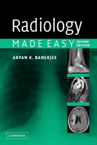 Könyv Radiology Made Easy Arpan K Banerjee