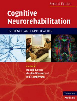Книга Cognitive Neurorehabilitation Donald T Stuss