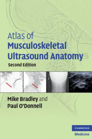 Könyv Atlas of Musculoskeletal Ultrasound Anatomy Michael Bradley