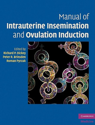 Kniha Manual of Intrauterine Insemination and Ovulation Induction RichardP Dickey