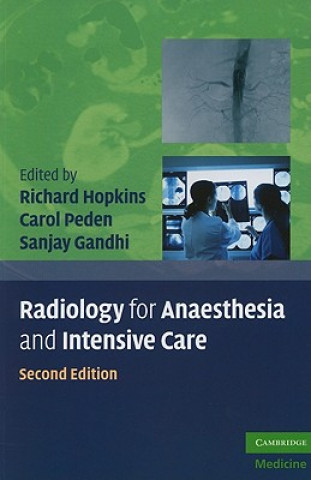 Könyv Radiology for Anaesthesia and Intensive Care Richard Hopkins