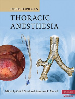 Könyv Core Topics in Thoracic Anesthesia Cait P Searl