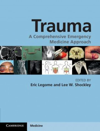 Книга Trauma Eric Legome