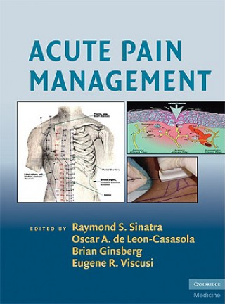 Book Acute Pain Management Raymond Sinatra
