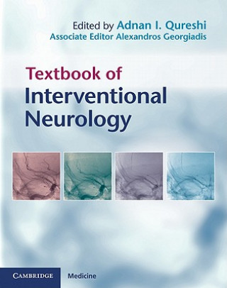 Kniha Textbook of Interventional Neurology Adnan I Qureshi
