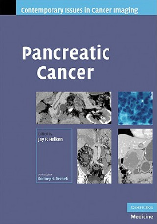 Kniha Pancreatic Cancer Jay Heiken