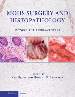 Книга Mohs Surgery and Histopathology Ken Gross