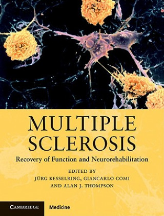 Carte Multiple Sclerosis Jurg Kesselring