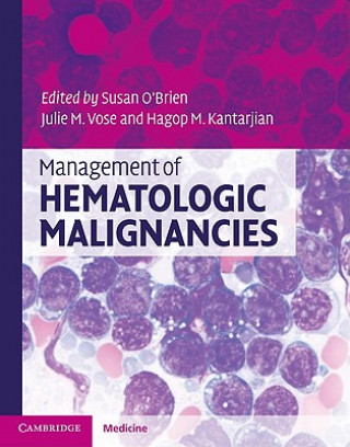 Book Management of Hematologic Malignancies Susan O´Brien