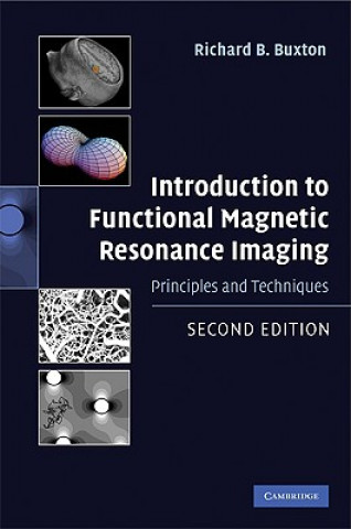 Kniha Introduction to Functional Magnetic Resonance Imaging Richard Buxton