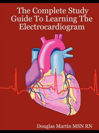 Carte Complete Study Guide To Learning The Electrocardiogram Douglas Martin MSN RN