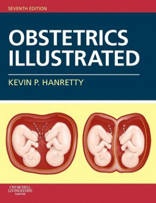 Książka Obstetrics Illustrated Kevin Hanretty