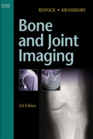 Kniha Bone and Joint Imaging Mark J. Kransdorf