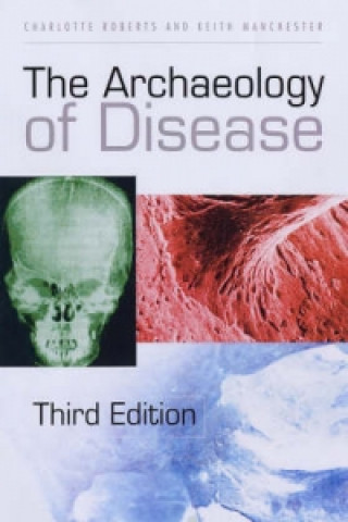 Książka Archaeology of Disease Keith Manchester